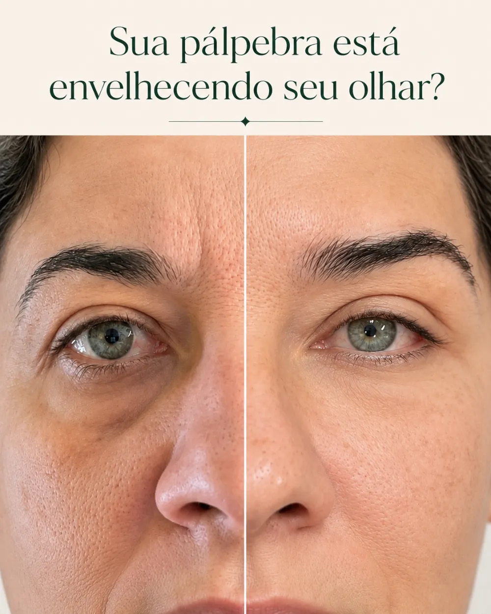 Sua pálpebra está envelhecendo seu olhar? Blefaroplastia na Clínica Eros